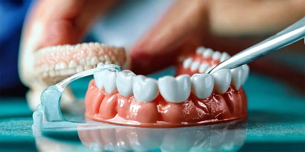 Close-up image of a denture undergoing a thorough cleaning process, emphasizing the importance of oral hygiene.